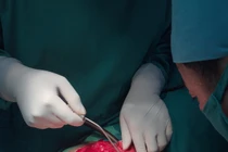 Liên tiếp phẫu thuật thành công nhiều ca bệnh hiếm đầu năm 2017