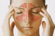 Biến chứng nguy hiểm của viêm xoang có thể gây tử vong