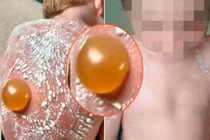 Sai lầm của mẹ có thể khiến bé tử vong ngày nắng