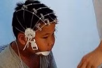 Bé trai mình đầy thương tích nghi do mẹ ghẻ bạo hành 