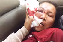 Cả nhà công an xã đánh một người ngất xỉu 