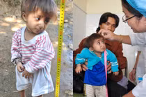 Bí ẩn "người lùn đầu chim" ở Bệnh viện Nhi Đồng 1