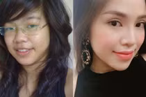 9X lột xác sau khi chi 6.500 USD phẫu thuật thẩm mỹ 
