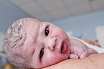 Những tác hại của sinh mổ với bé rất cần biết