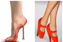 Bệnh hiểm của người mẫu Thái Hà kẻ thù của gái điệu