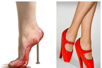 Bệnh hiểm của người mẫu Thái Hà kẻ thù của gái điệu