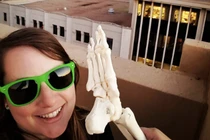 Ngưỡng mộ những bệnh nhân ung thư nghị lực nhất