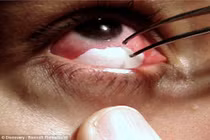 6 sự kiện y học kỳ lạ nhất thế giới năm 2015