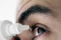 Bài thuốc trị đau mắt đỏ bằng đông y