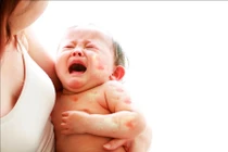 8 loại thực phẩm dễ gây dị ứng nhất cho trẻ