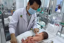 Cận cảnh khối u “thai ký sinh” trên người bệnh nhi