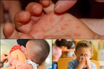 Tuyệt chiêu phòng bệnh cho bé khi trời lạnh 