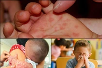 Tuyệt chiêu phòng bệnh cho bé khi trời lạnh 