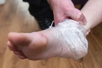 Cảnh giác tai nạn bé dễ gặp khi trời giá rét