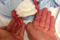 Rơi nước mắt trước bức ảnh vĩnh biệt đứa con chưa chào đời