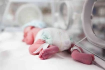 Bé nhiễm trùng máu được chữa thế nào để tránh tử vong