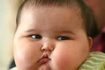 Trẻ béo phì có nguy cơ bị ung thư gan khi về già