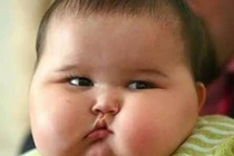 Trẻ béo phì có nguy cơ bị ung thư gan khi về già