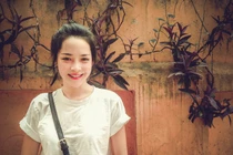 Ảnh mỹ nhân dao kéo Nam Định sau lần phẫu thuật cuối