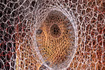 Truy tìm bí mật của bệnh ung thư di căn