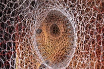 Truy tìm bí mật của bệnh ung thư di căn