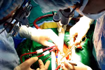 Cứu sống nạn nhân bị dao đâm máu phun dữ dội