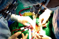 Cứu sống nạn nhân bị dao đâm máu phun dữ dội