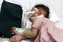 Những phương pháp hạn chế biến chứng khi mắc sởi