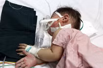 Những phương pháp hạn chế biến chứng khi mắc sởi