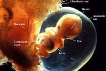 Chuyên gia giải mã nỗi ám ảnh mang tên "tắc mạch ối" 