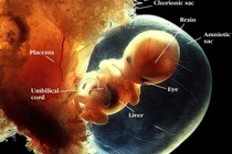 Chuyên gia giải mã nỗi ám ảnh mang tên "tắc mạch ối" 