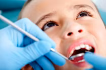 Những bệnh răng miệng bé dễ mắc