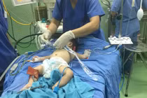 Bé trai biến thành gái vì có 2 bộ phận sinh dục