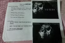 Chẩn đoán sai suýt chết thai, BV muốn gửi thư xin lỗi