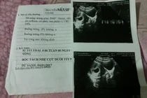 Chẩn đoán sai suýt chết thai, BV muốn gửi thư xin lỗi