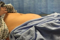 Nhiễm độc băng vệ sinh người mất trí nhớ, kẻ bị thần chết sờ gáy