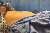 Nhiễm độc băng vệ sinh người mất trí nhớ, kẻ bị thần chết sờ gáy