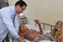 Nổ biến áp ở Sài Gòn, 2 nhân viên điện lực bỏng nặng