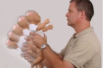 Bé sơ sinh phải mổ não vì ông bà bế rung lắc quá mạnh