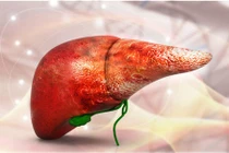 11 dấu hiệu chứng tỏ lá gan của bạn đang kêu cứu 