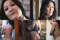 Choáng váng làn da nhăn nhúm như bà già 80 của người mẫu 26 tuổi