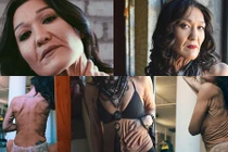 Choáng váng làn da nhăn nhúm như bà già 80 của người mẫu 26 tuổi