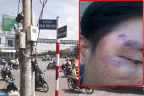 Khi “công bộc” của dân hành xử như... côn đồ