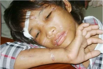 Xót lòng những em bé bị bạo hành như thời trung cổ