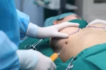 Phẫu thuật thẩm mỹ ở Hà Nội đến đâu yên tâm nhất