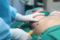 Phẫu thuật thẩm mỹ ở Hà Nội đến đâu yên tâm nhất