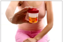 Giải mã lý do bất ngờ khiến bạn tiểu ra máu cục