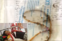 Rùng mình kim tiêm, gạc... bác sĩ bỏ quên khi phẫu thuật