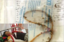 Rùng mình kim tiêm, gạc... bác sĩ bỏ quên khi phẫu thuật