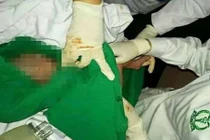 Bác sĩ dùng đèn smartphone đỡ đẻ giữa đêm